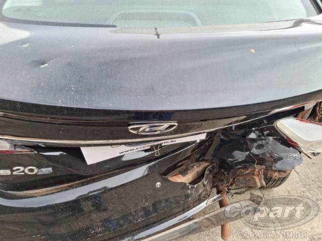 2017 HYUNDAI HB20S 
