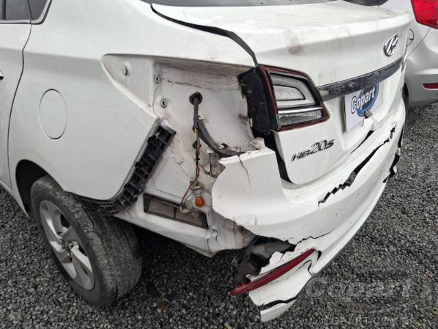 2016 HYUNDAI HB20S 