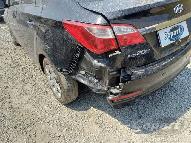 2017 HYUNDAI HB20S 