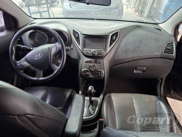 2015 HYUNDAI HB20S 