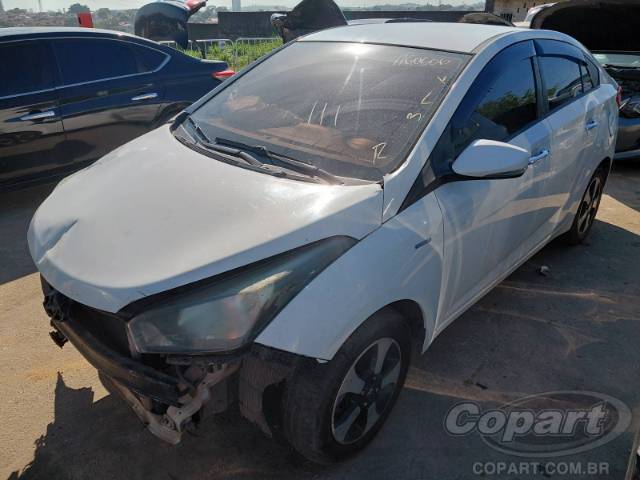 2015 HYUNDAI HB20S 
