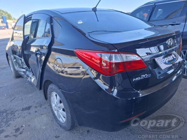 2015 HYUNDAI HB20S 