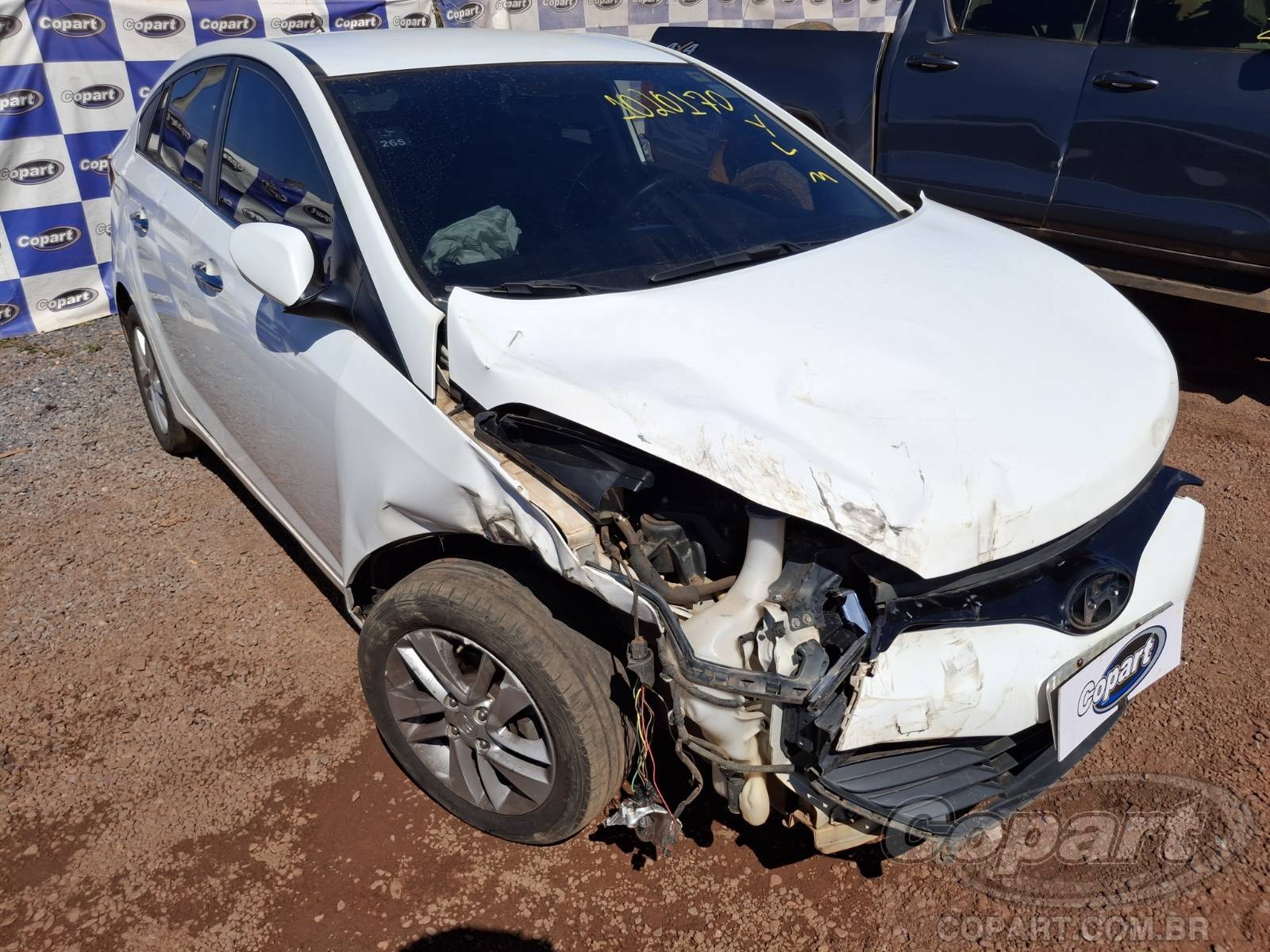 HYUNDAI HB20S Premium 1.6 16V CVVT 2015