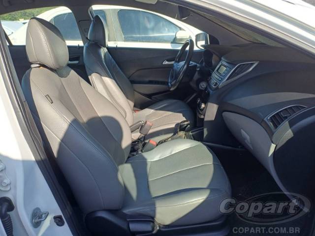 2017 HYUNDAI HB20S 