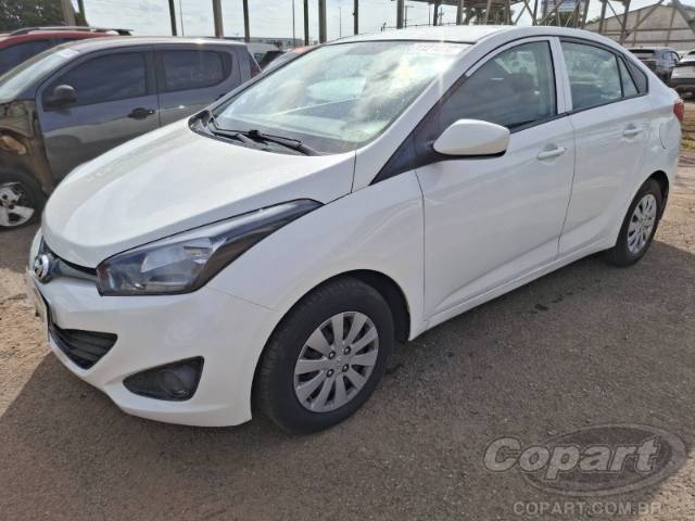 2015 HYUNDAI HB20S 