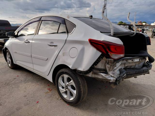 2018 HYUNDAI HB20S 