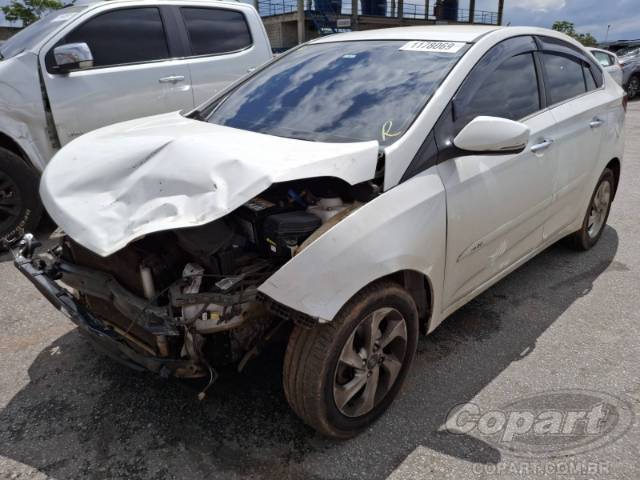 2018 HYUNDAI HB20S 
