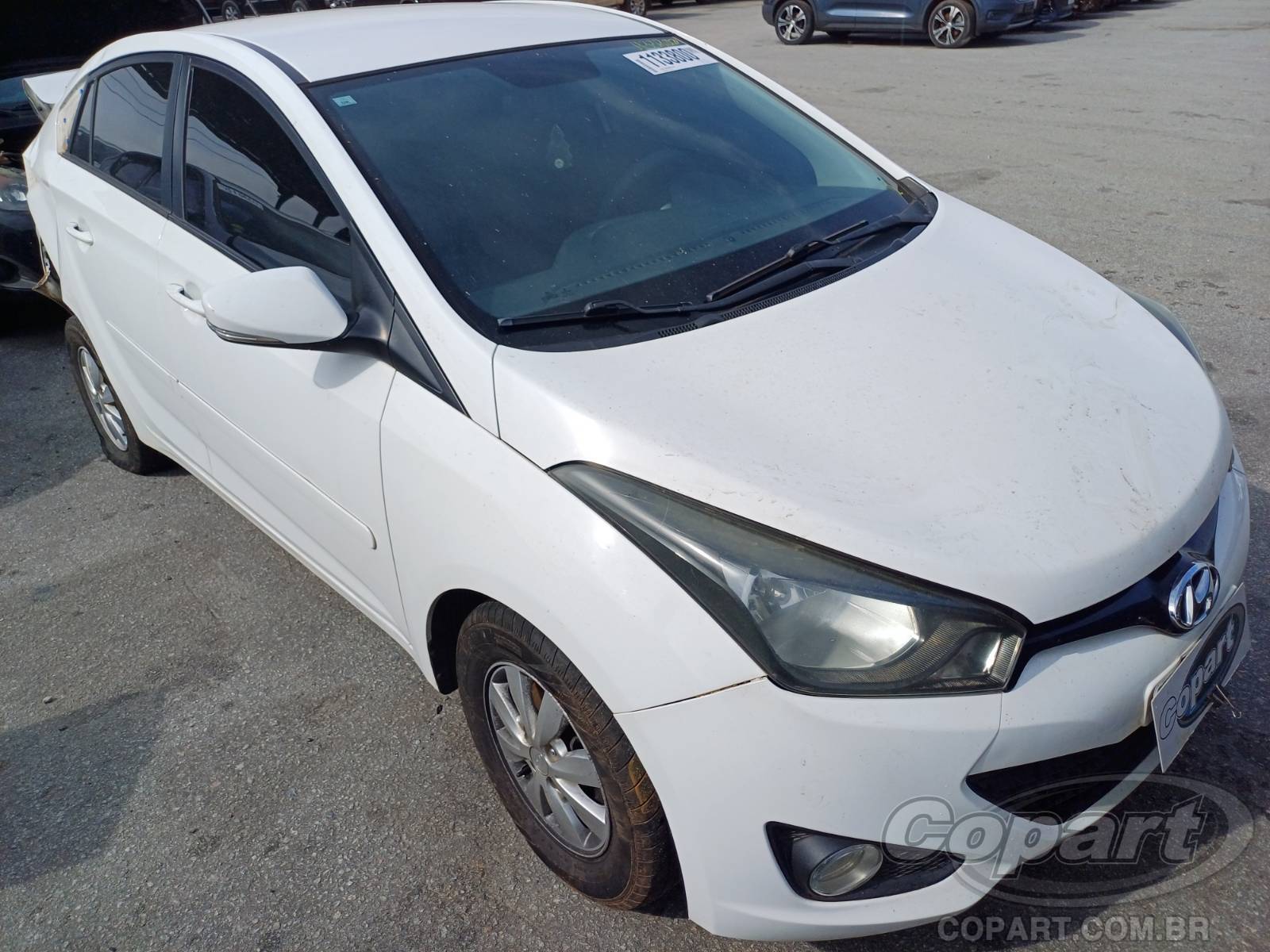 Hyundai Hb20s 2015 em leilão