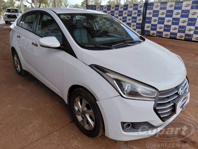 2018 HYUNDAI HB20S 