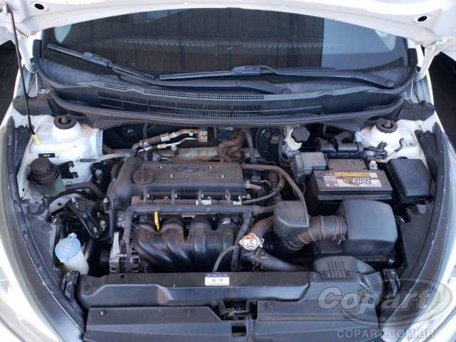 2018 HYUNDAI HB20S 