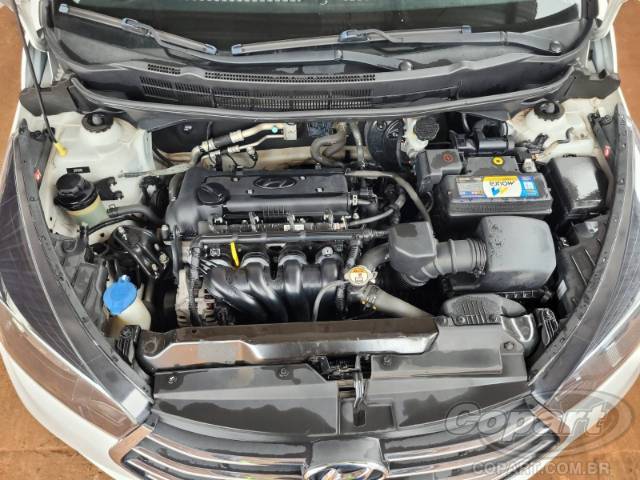 2018 HYUNDAI HB20S 