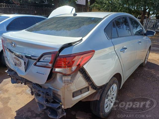 2018 HYUNDAI HB20S 