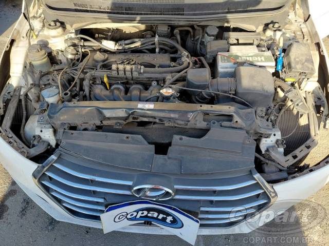 2018 HYUNDAI HB20S 