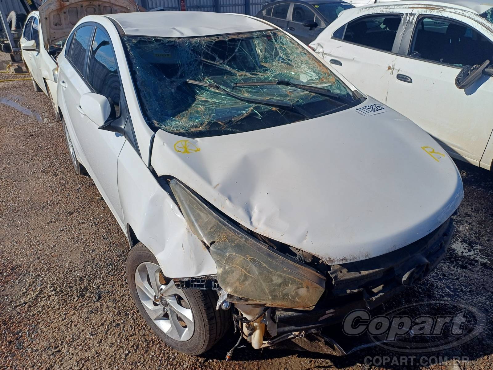 Hyundai HB20S