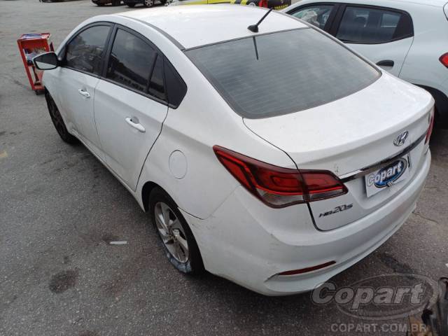 2017 HYUNDAI HB20S 